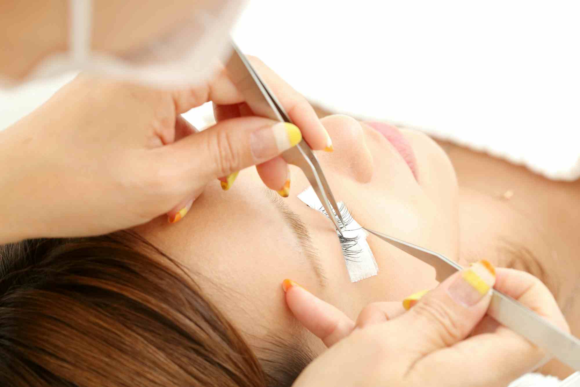 まつエク施術で起こりやすいアレルギーとは? 予防する方法はあるの?