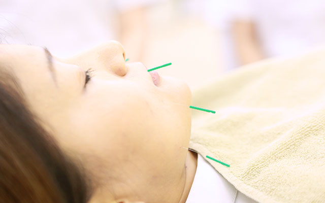 鍼灸