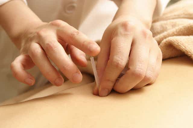 鍼灸師を辞めたいと思う理由とは?転職のためにやるべきこととや理想の職場を見つける方法も紹介