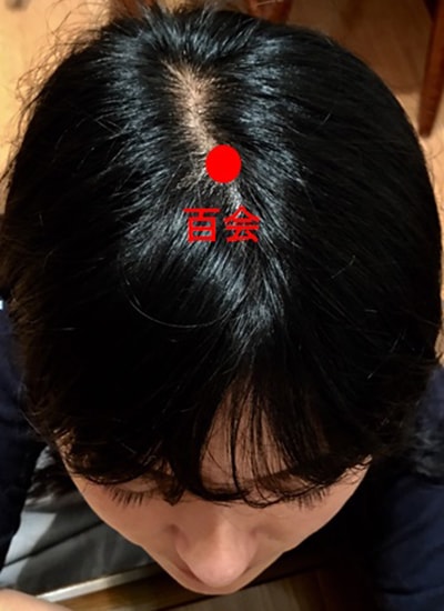 「百会」のツボ