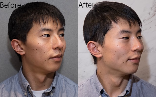 男のエステ ダンディハウス