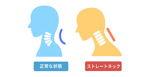 ストレートネックを改善するために