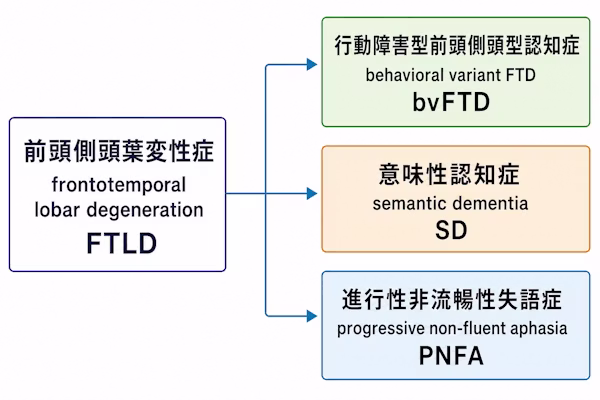 前頭側頭葉変性症（FTLD）の臨床的分類を示す図。FTLDが、行動障害型前頭側頭型認知症（bvFTD）、意味性認知症（SD）、進行性非流暢性失語症（PNFA）の3つのタイプに分かれることを表している。