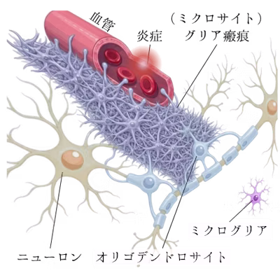 脳内の炎症・グリア璐痕形成を示す医学イラスト。血管・ニューロン・オリゴデンドロサイト・ミクログリアの位置関係