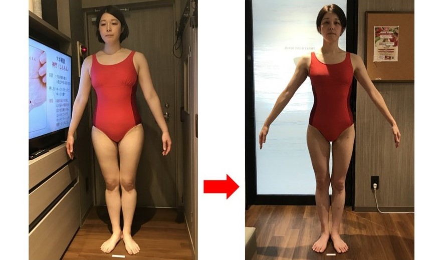 Y.Y様（32歳・169.0cm）