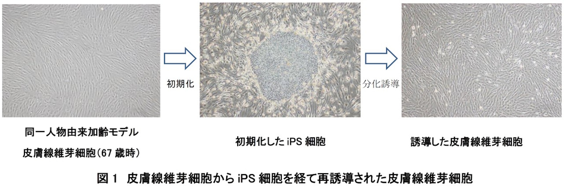 2018年には、67歳ドナーの線維芽細胞を初期化したiPS細胞から、皮膚線維芽細胞への分化誘導に成功。誘導した細胞のテロメア長は元の細胞より伸長し、ミトコンドリア内の抗酸化物質が増加していることが確認された<br>資料提供／コーセー
