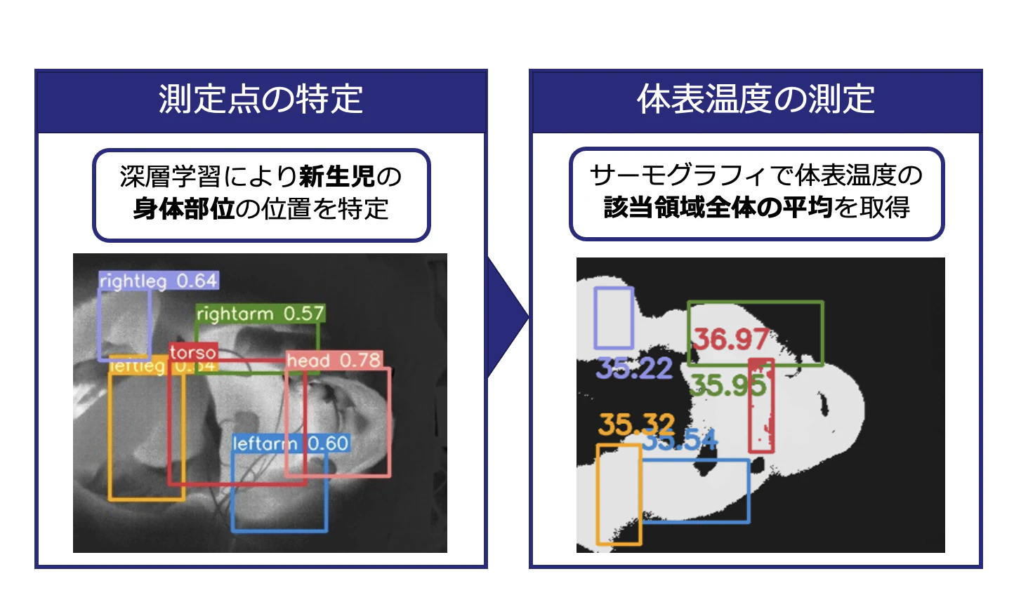 新生児熱画像を用いた体温抽出のための身体部位検出法