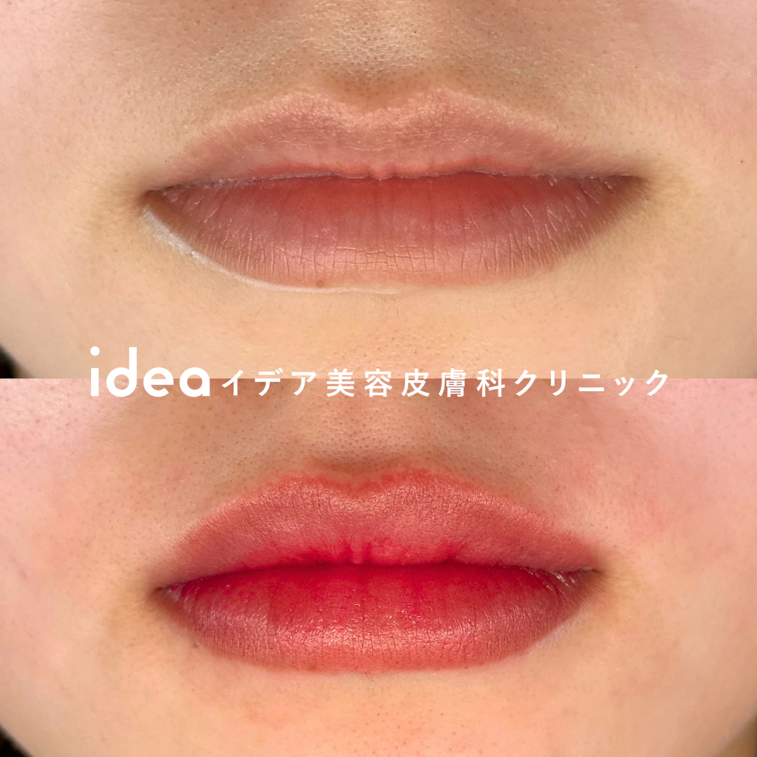 アートメイク1回（リップ）