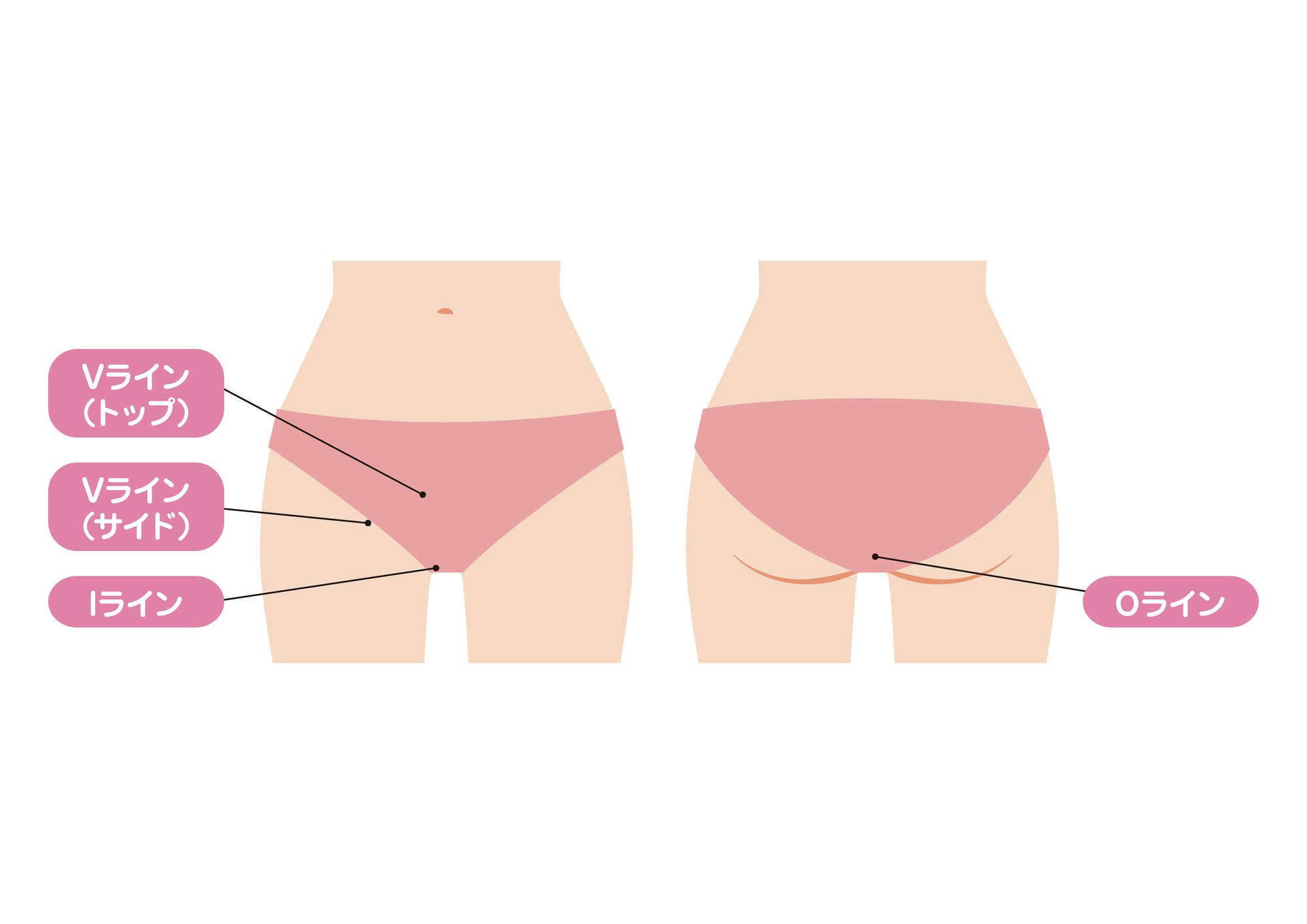 VIO脱毛のメリットは?気になる痛みや期間についても解説