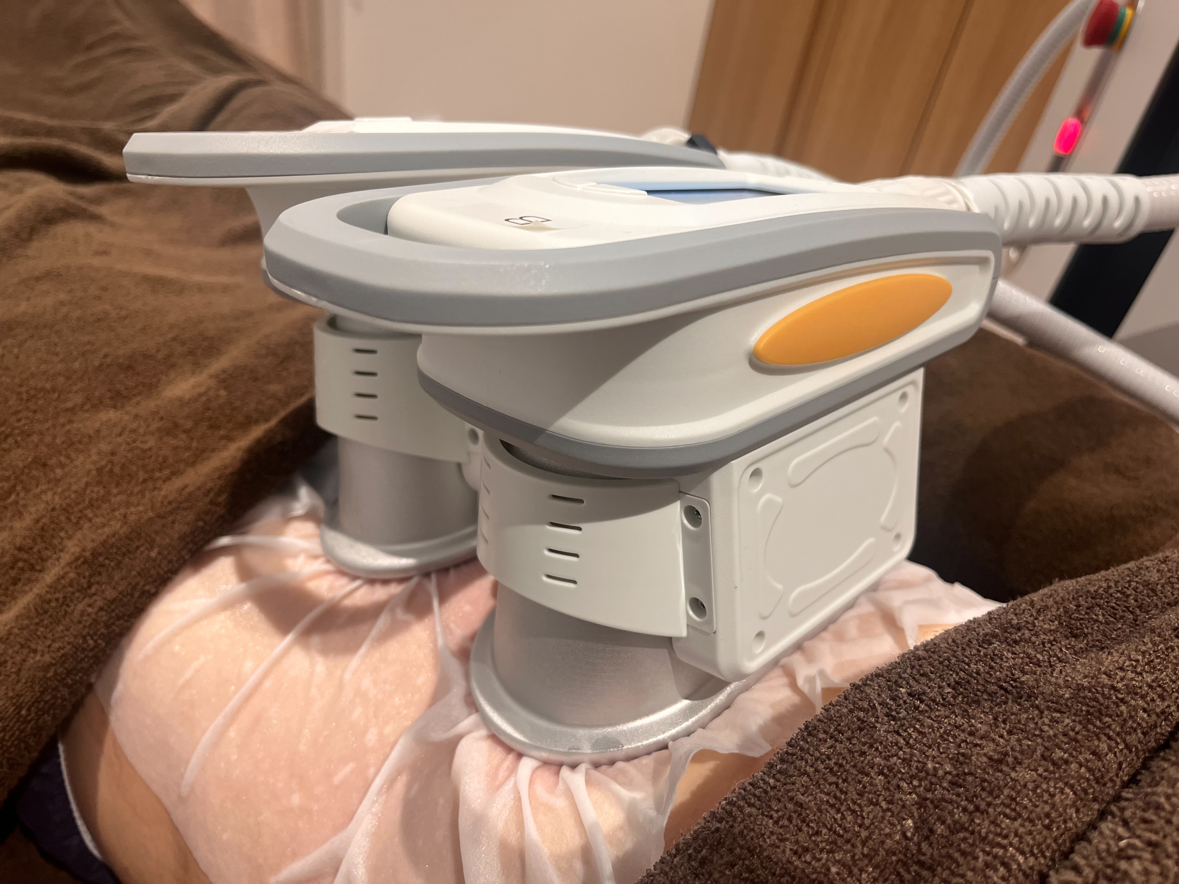 脂肪冷却の効果は?気になるお腹や太ももへの効果を医師が解説!