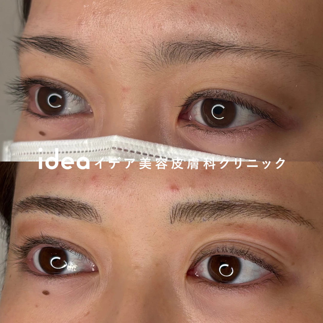 アートメイク眉2回（4Dストローク）