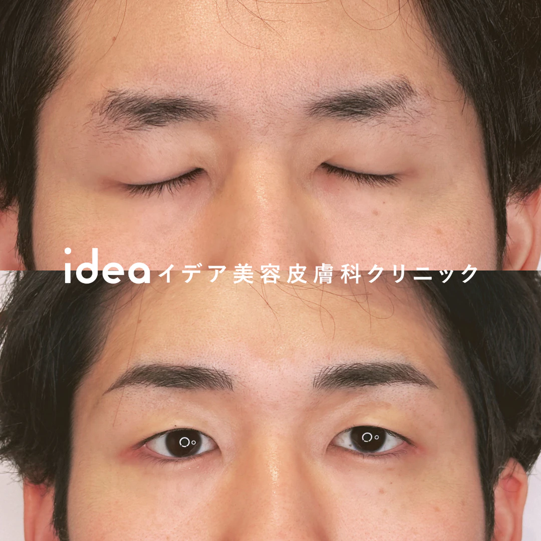 アートメイク眉1回（4Dストローク）