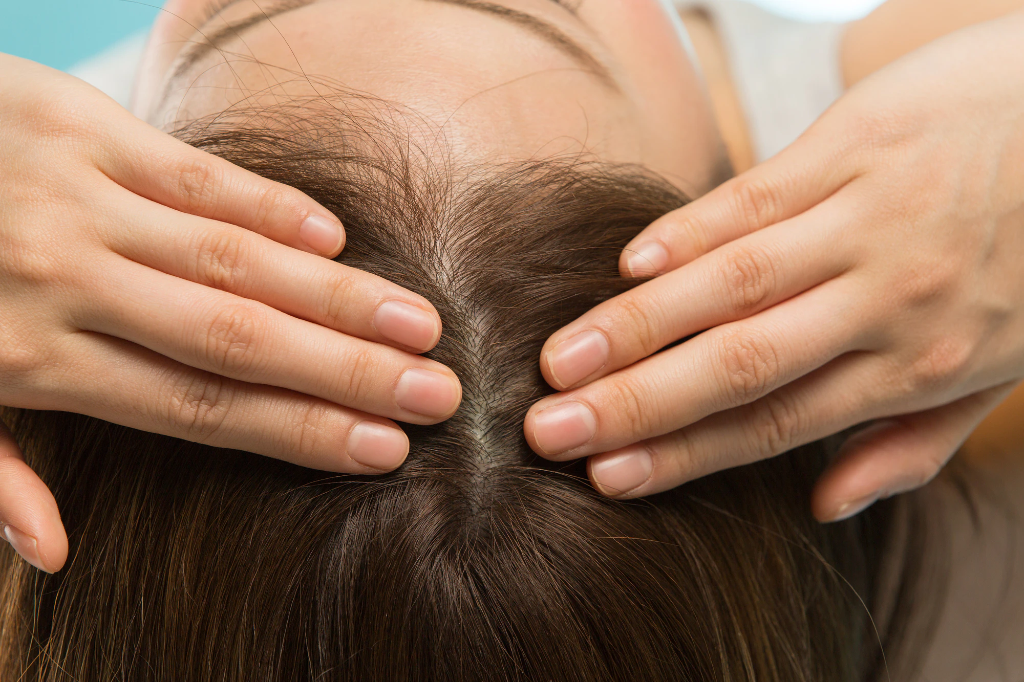 ミノキシジルは女性の薄毛治療にも有効？期待できる効果と注意点