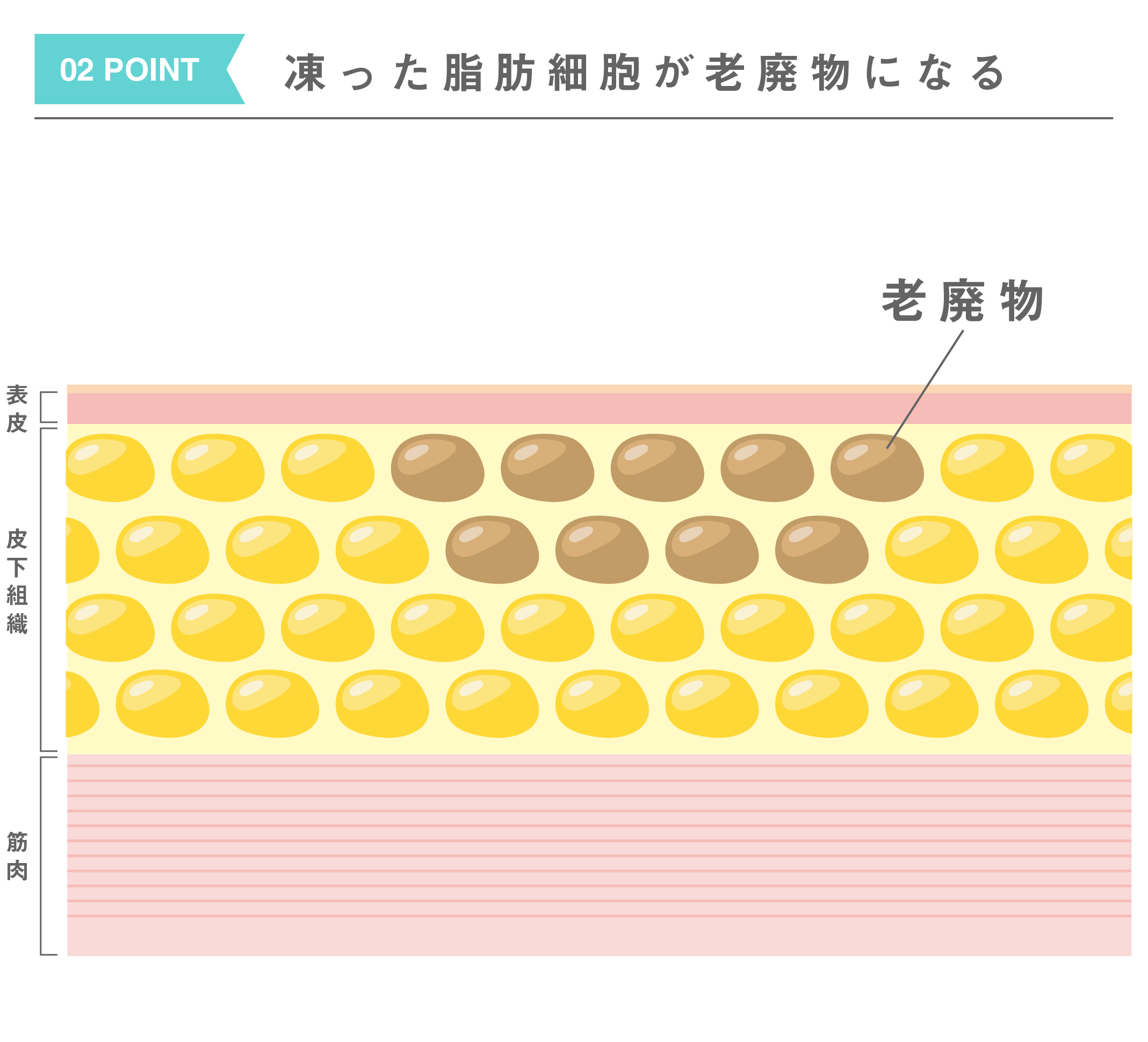 脂肪冷却痩身|脱毛・ニキビ治療・ダイエットのイデア美容皮膚科 脂肪冷却痩身|脱毛・ニキビ治療・ダイエットのイデア美容皮膚科