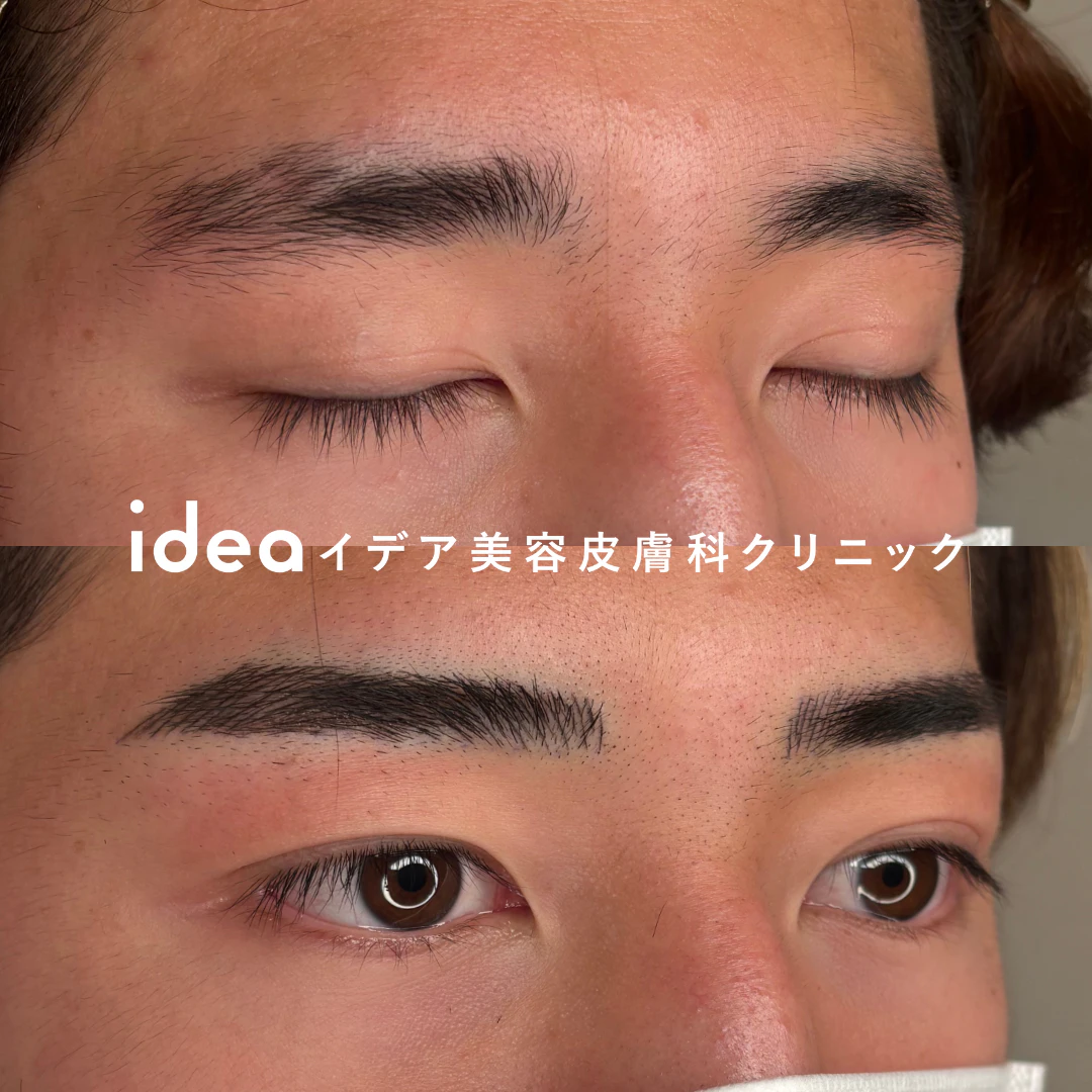アートメイク眉2回（4Dストローク）