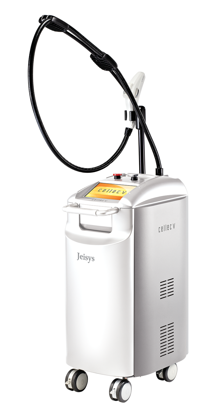 しみ・そばかす治療｜脱毛・ニキビ治療・ダイエットのイデア美容皮膚科