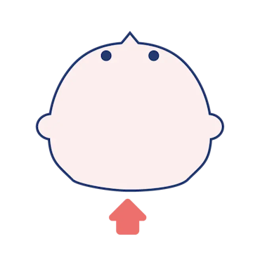 短頭症のイメージ