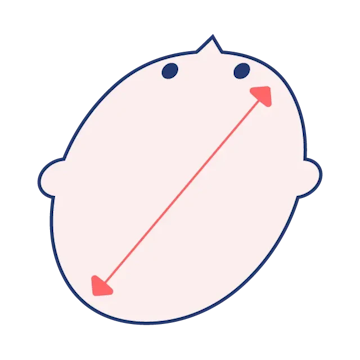 斜頭症のイメージ