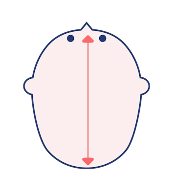 長頭症のイメージ