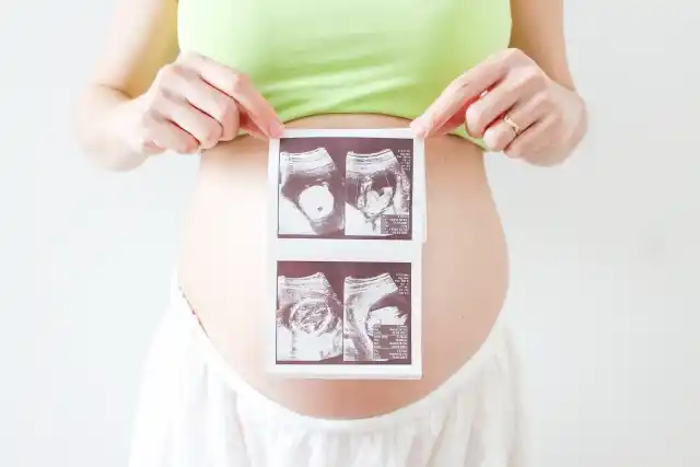 妊婦 エコー写真