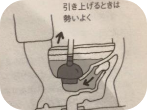 知っておきたい！ラバーカップの使い方