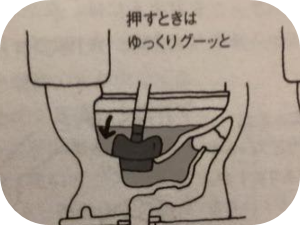 知っておきたい！ラバーカップの使い方
