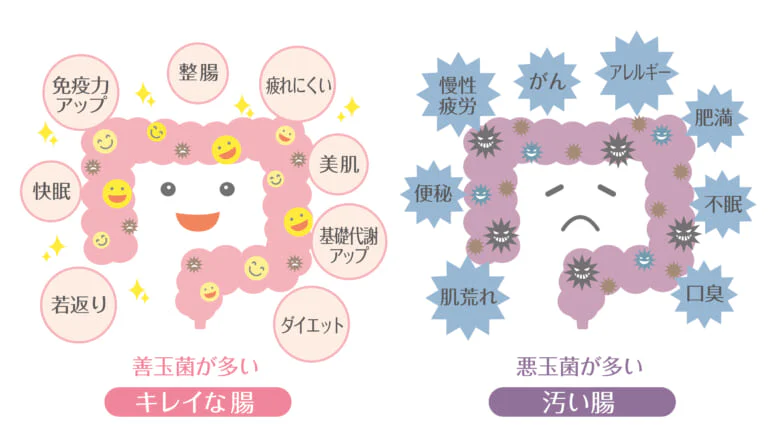 まずは、腸内環境を整えることから