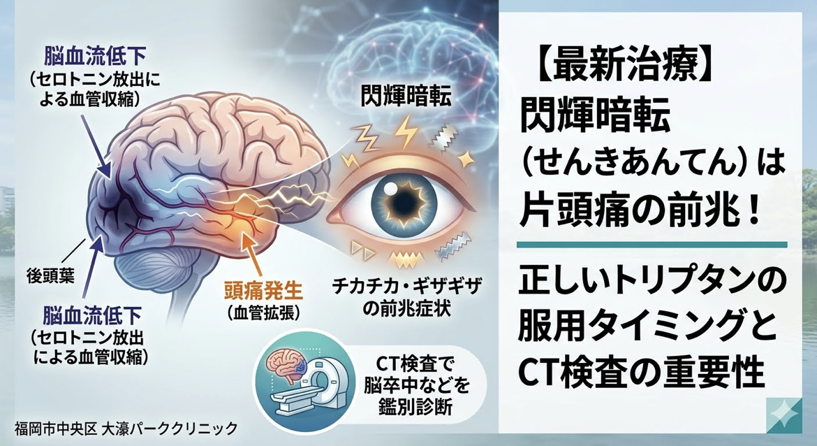 閃輝暗転点片頭痛のサイン！チカチカの原因・トリプタンのタイミングとCT検査の重要性