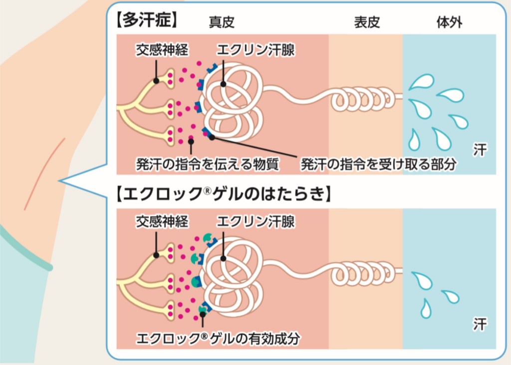 エクロックゲルの機序