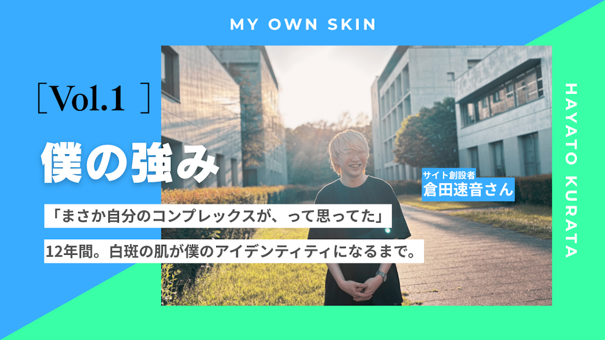 #01 「隠す」でも「治す」でもない。コンプレックスが「僕の強み」に変わるまで。【倉田速音・24歳】