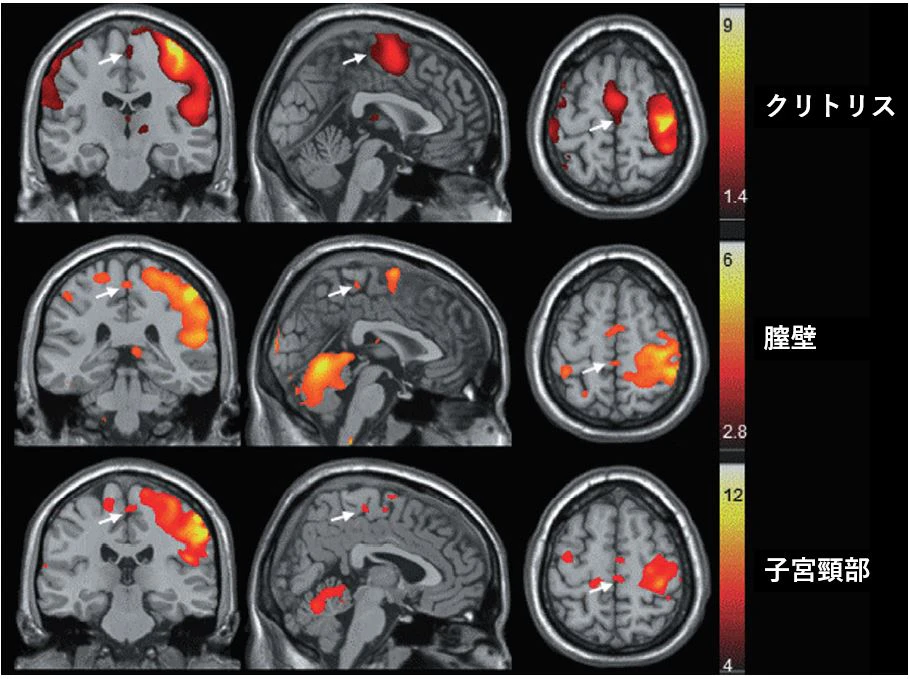 クリトリス 腟 子宮頸部 ポルチオ 脳 fMRI 体性感覚野