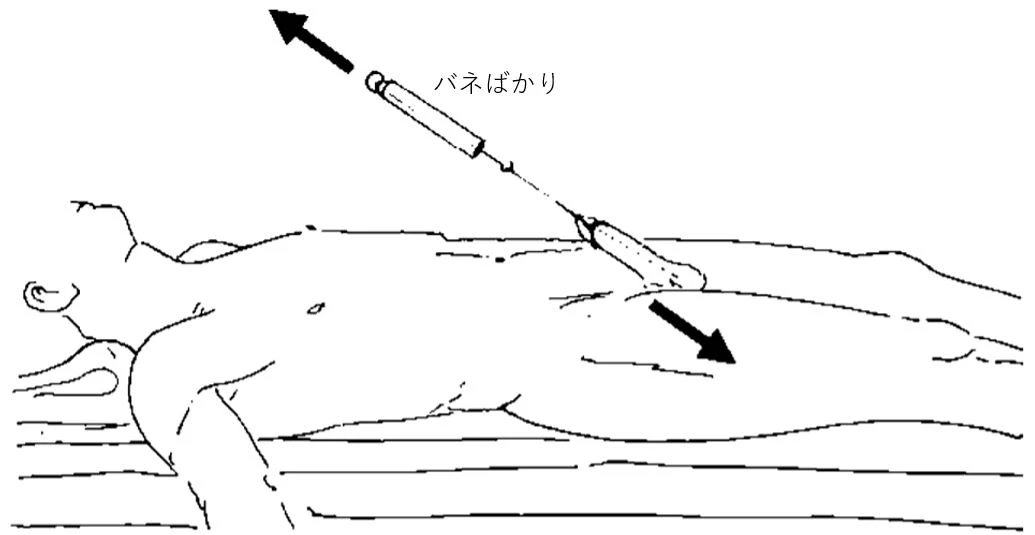 勃起 測定 骨盤底筋力