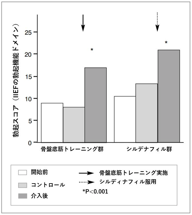 骨盤底筋トレーニング 勃起薬 ED改善