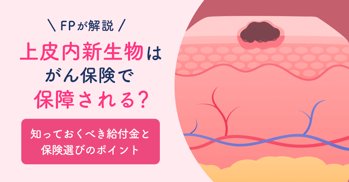 上皮 内 新 生物 と は