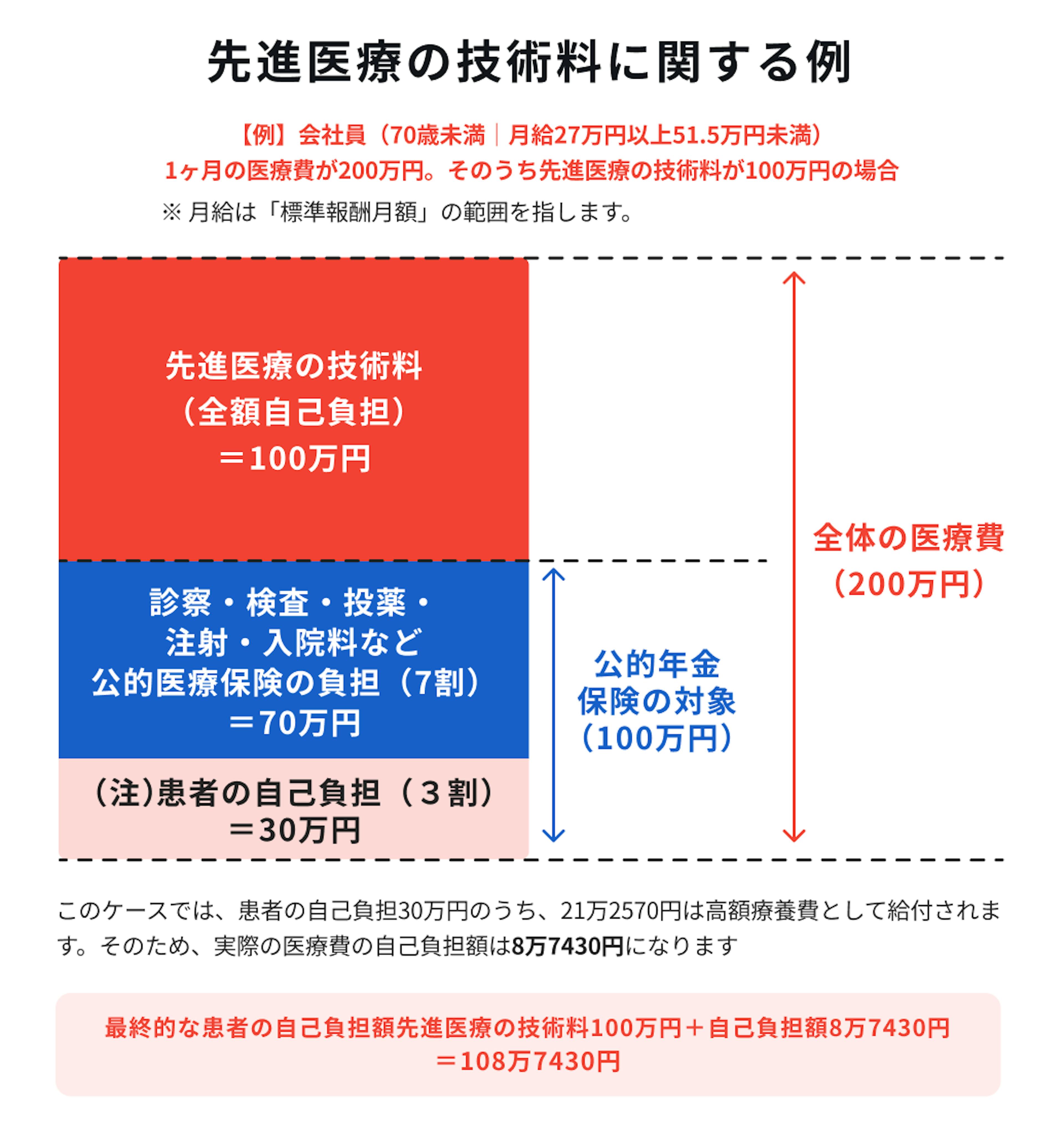 先進医療の技術料に関する例