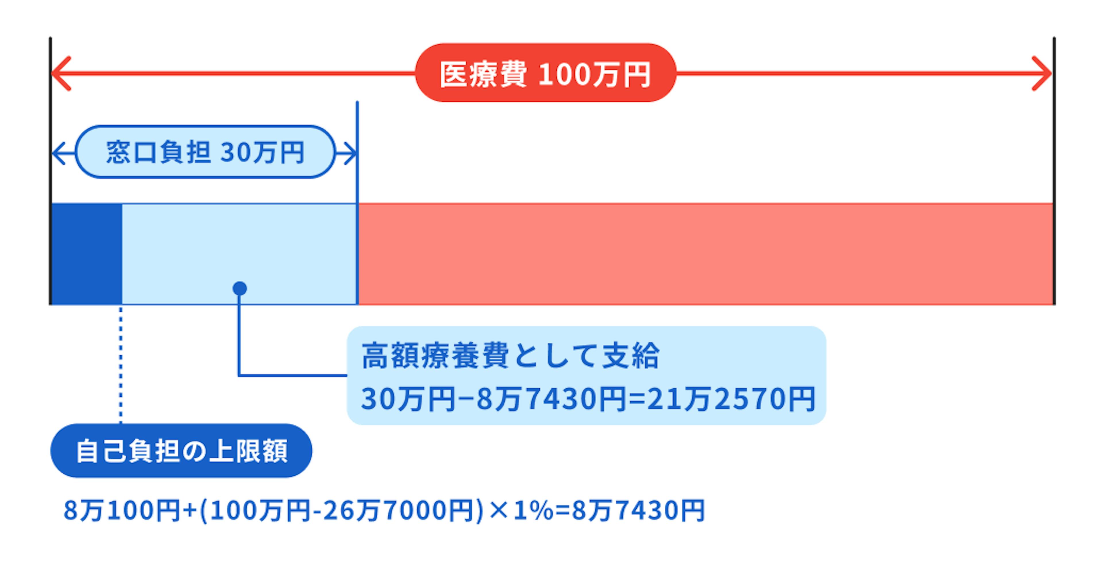年収500万円の人が高額療養費制度を利用した場合の自己負担額8万7430円の図式。