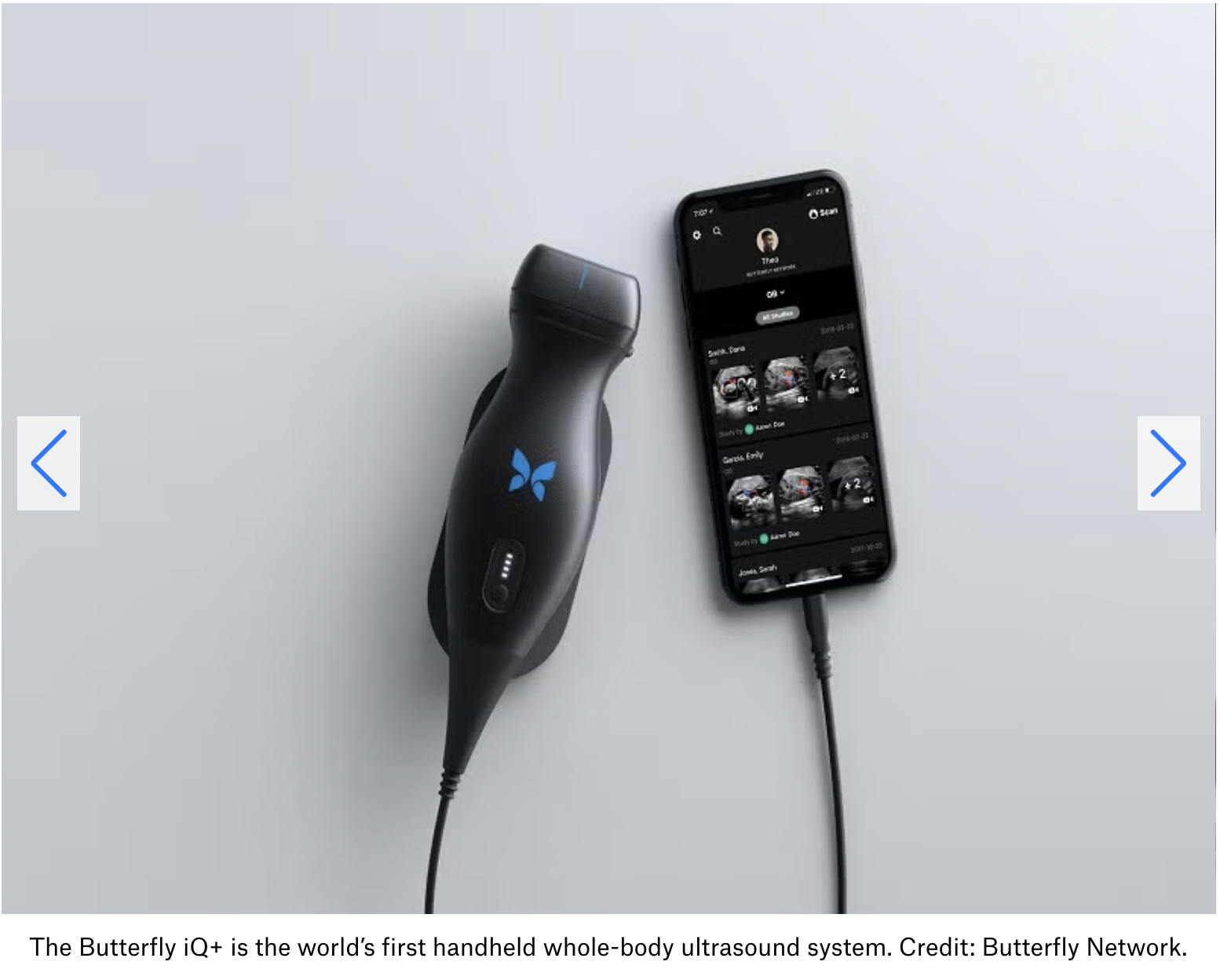Butterfly iQ+の携帯型超音波デバイスとスマートフォン連携画面