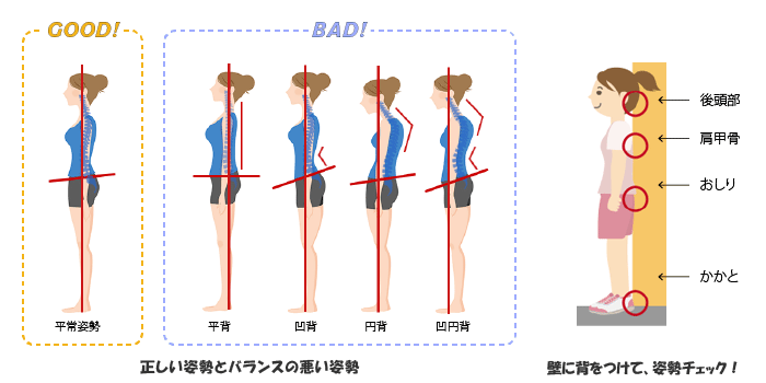 腰痛を引き起こす原因となる姿勢を説明する画像