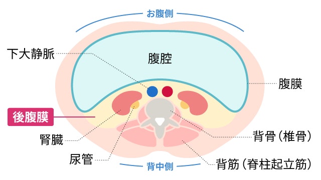 後腹膜線維症について説明する図です