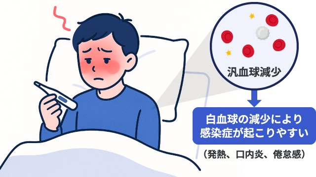 再生不良性貧血における白血球減少と感染症リスクのメカニズム図解。汎血球減少により白血球が減り、細菌やウイルスに感染しやすくなり、「発熱」「口内炎」「強い倦怠感」といった症状が起きる様子を、発熱している人のイラストで説明。