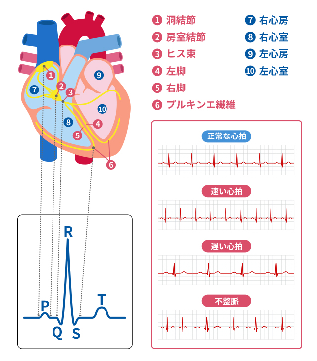 心電図のイラスト