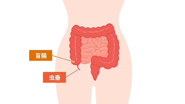 盲腸と虫垂の部位についての図です