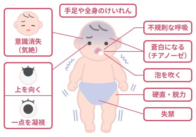 熱性けいれんを説明する図です