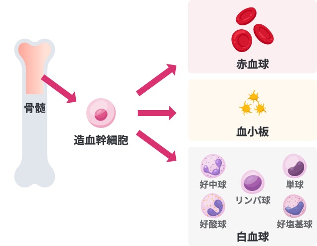 再生不良性貧血の解説において、正常な場合は骨髄で造血幹細胞が赤血球・血小板・白血球（好中球・リンパ球・単球・好酸球・好塩基球）へ分化することを示すイラスト。
