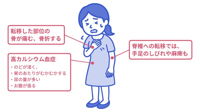 乳がんが骨に転移した場合の症状を説明する図です