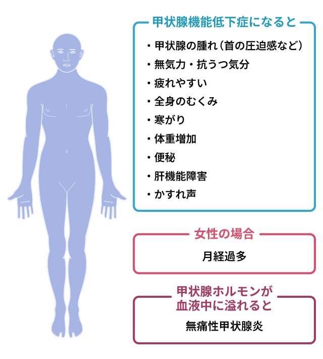 橋本病の症状のイラスト