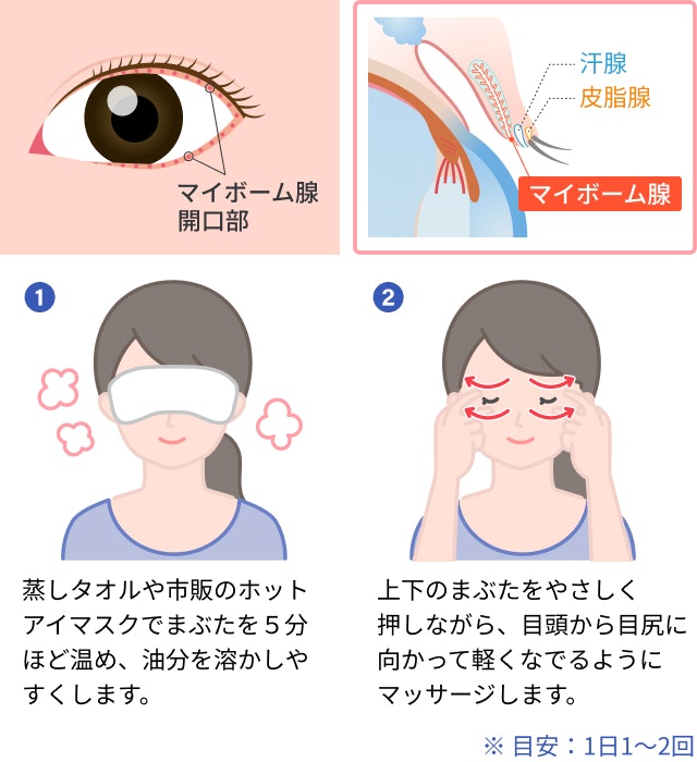 マイボーム腺マッサージを説明する図です