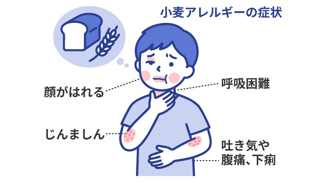 小麦を含む食品を食べてすぐに皮膚が赤くなったり、かゆくなったり、蕁麻疹が出たりします。