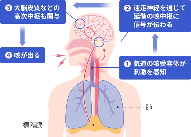 咳嗽（咳が出る）の仕組みを説明する図です