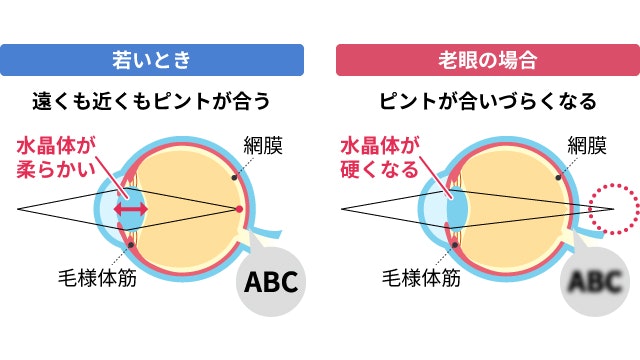 老眼の原因について説明する図です